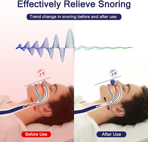 Dispositivo portátil de alivio para la apnea del sueño, sistema de soporte de vías respiratorias nasales antirronquidos para viajes, hogar y dormitorio, clips de silicona suave para los oídos, recargable por USB