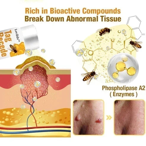 Spray para eliminar verrugas y etiquetas cutáneas con extracto natural de veneno de abeja para un cutis sin imperfecciones con tratamiento en casa