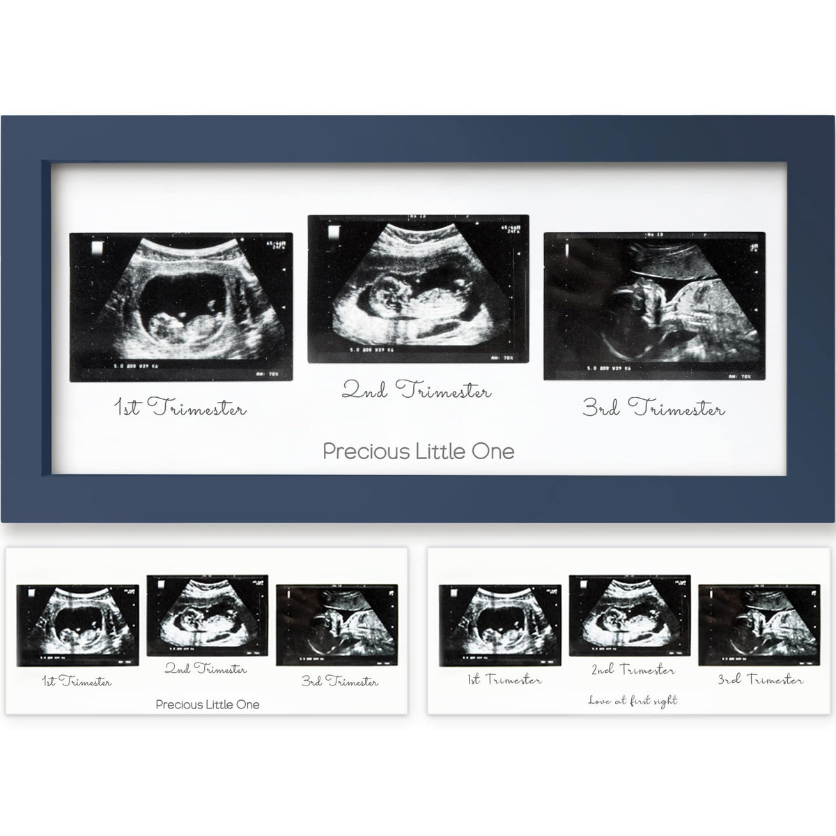 Baby Sonogram Picture Frame