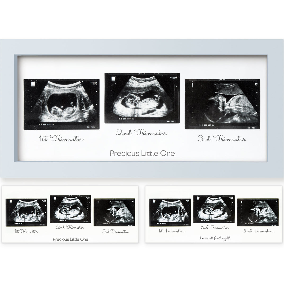 Baby Sonogram Picture Frame