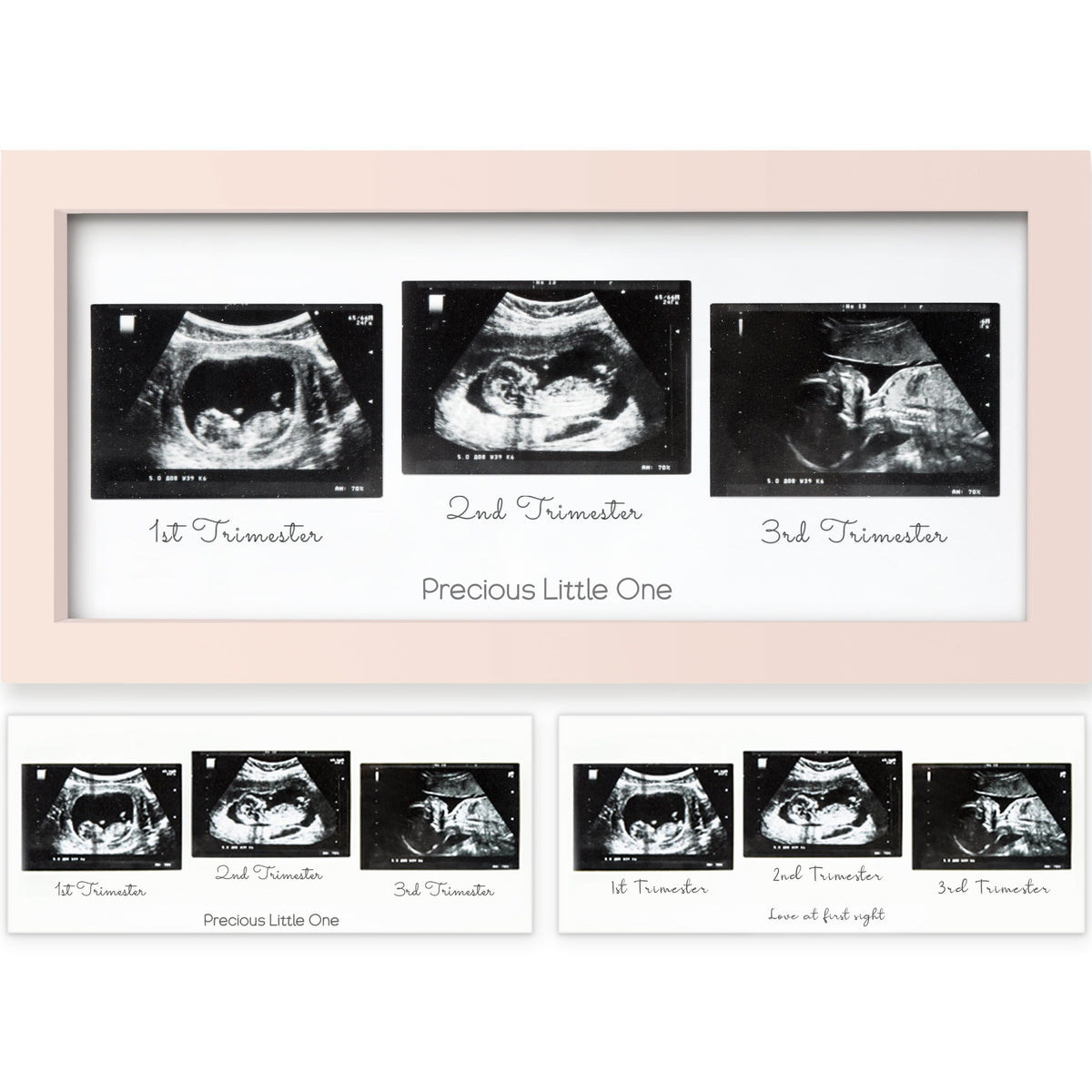 Baby Sonogram Picture Frame