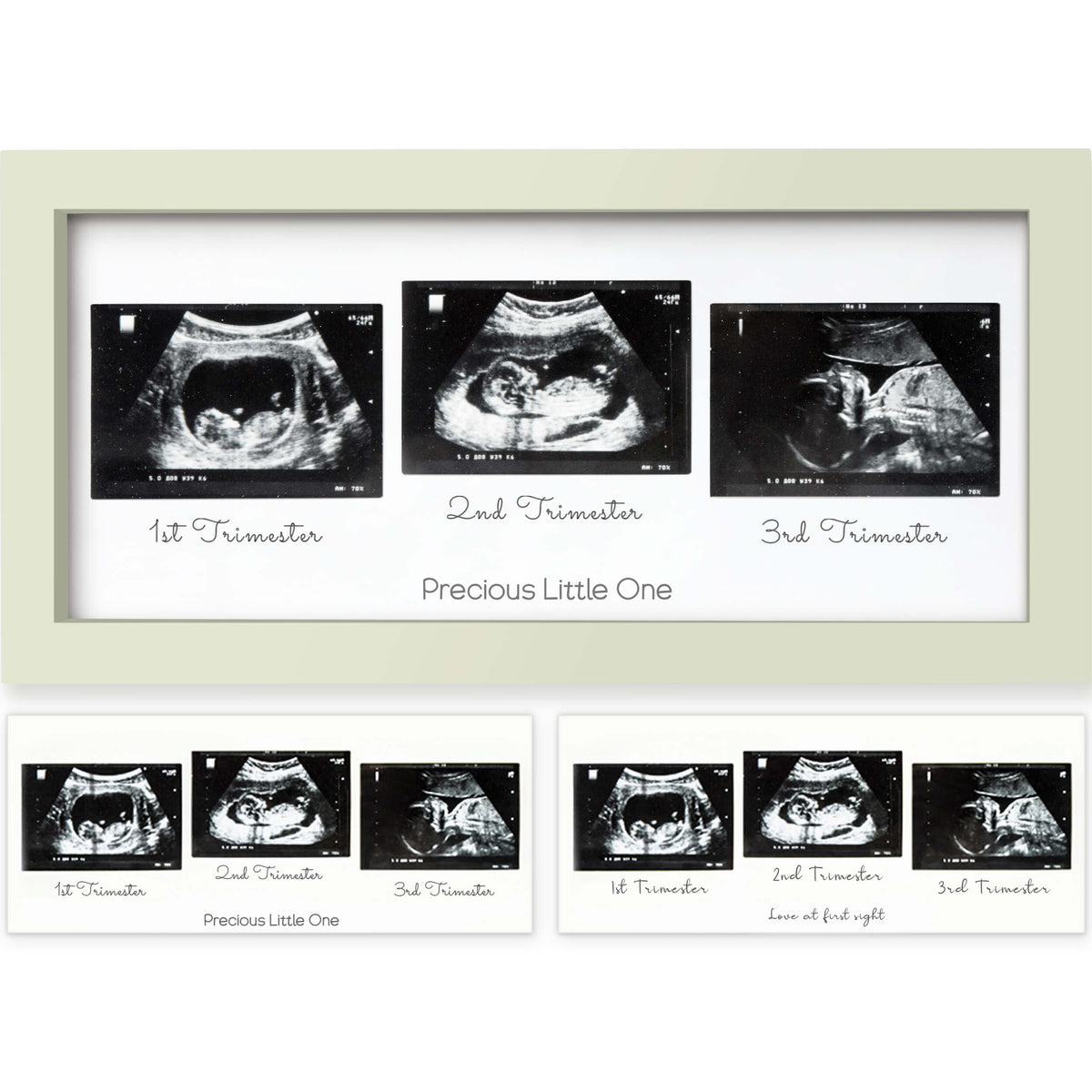 Baby Sonogram Picture Frame