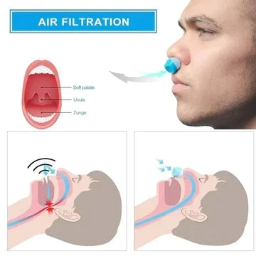 Oplaadbare microventilator voor een betere neusademhaling tijdens het slapen – Snoerloos, zakformaat ontwerp voor op reis, kamperen en in hotels | Thomler