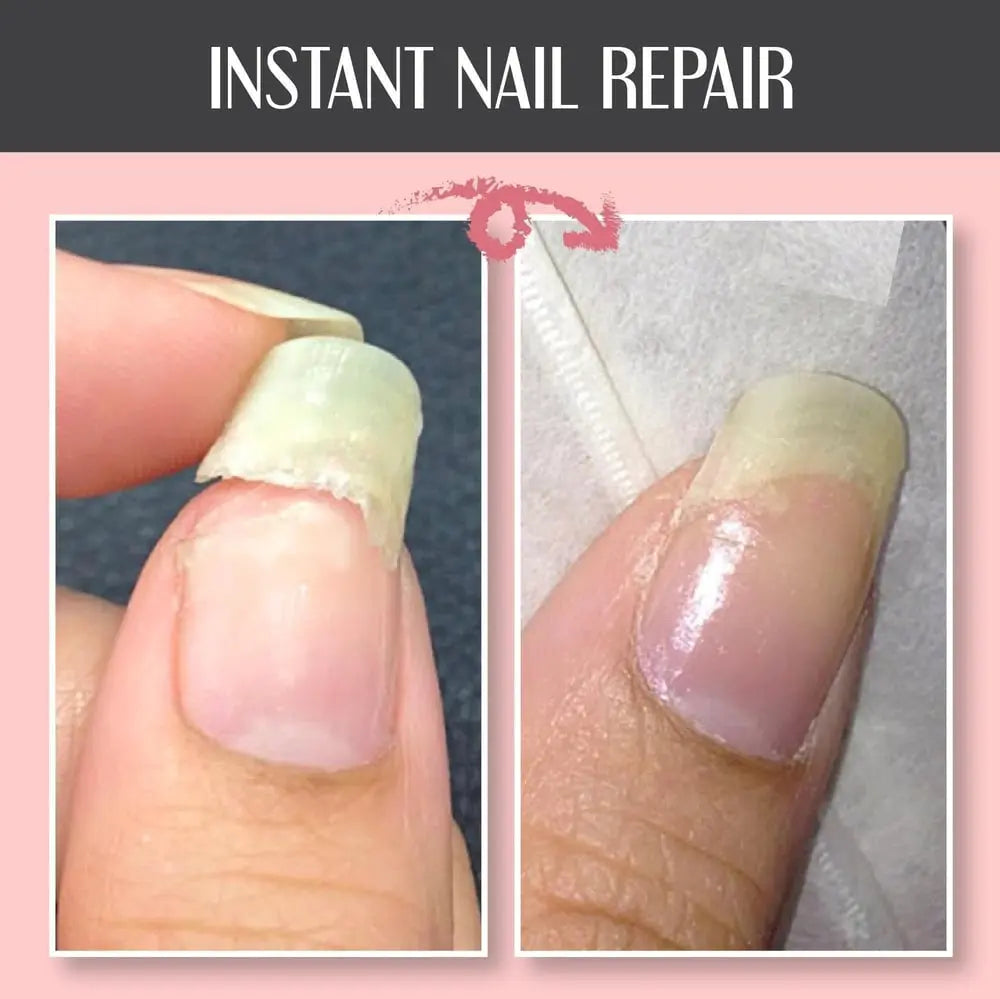 Nail Repair Gel for Cracked & Damaged Nails – No UV Light Required – Clear Protective Coating for Natural Nails | Thomler
