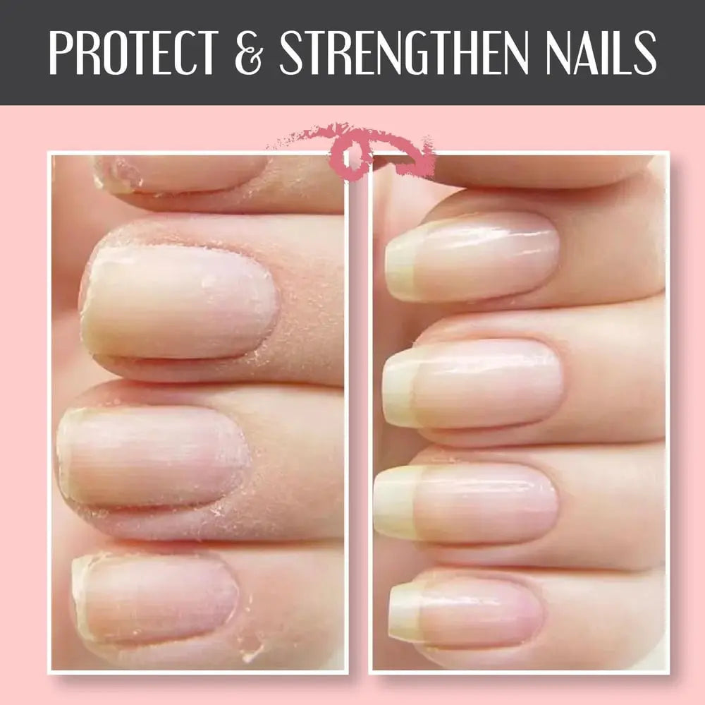Nail Repair Gel for Cracked & Damaged Nails – No UV Light Required – Clear Protective Coating for Natural Nails | Thomler