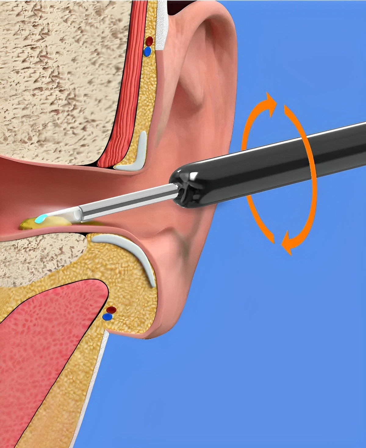 EarBit 3000 – Ohrenreiniger mit Kamera
