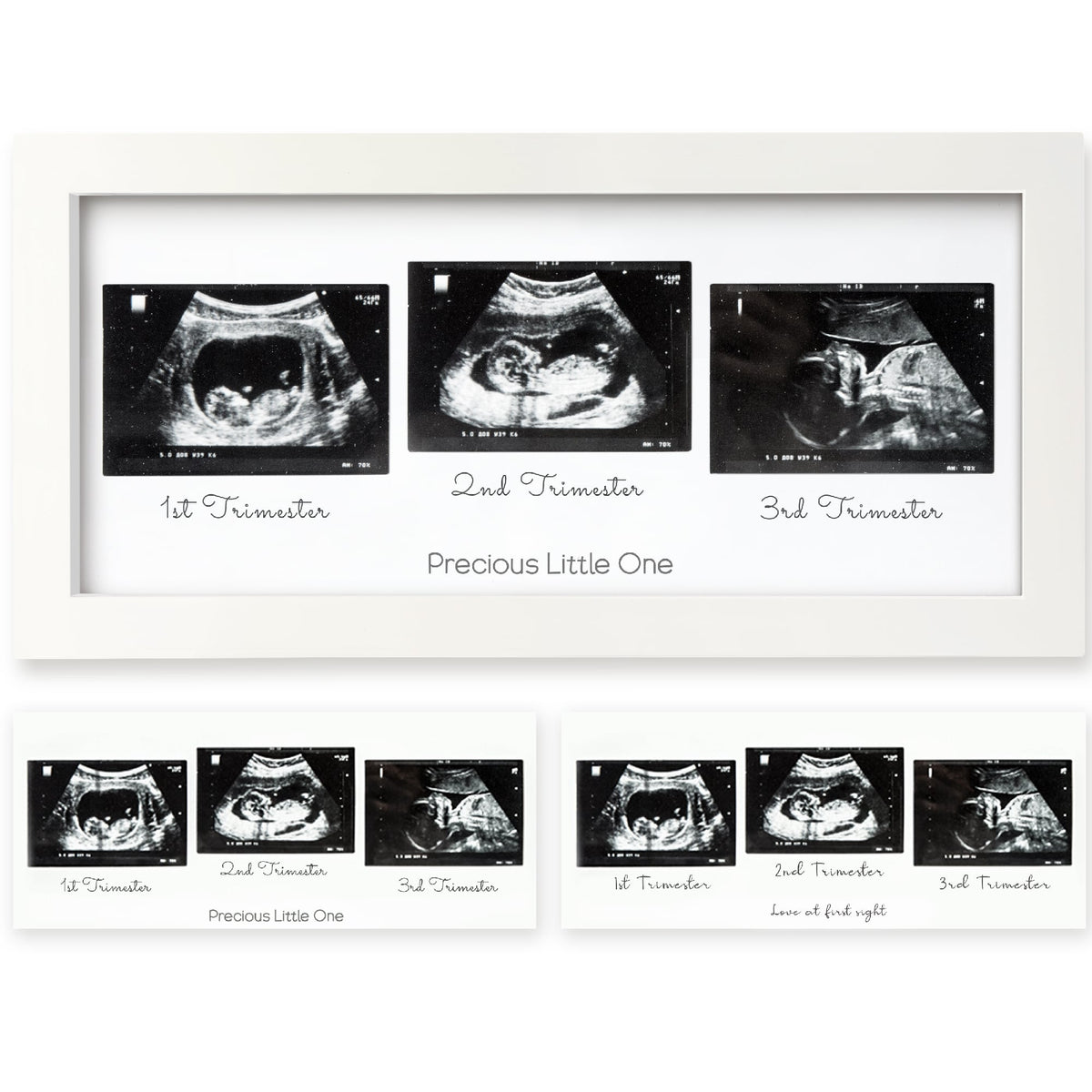 Baby Sonogram Picture Frame