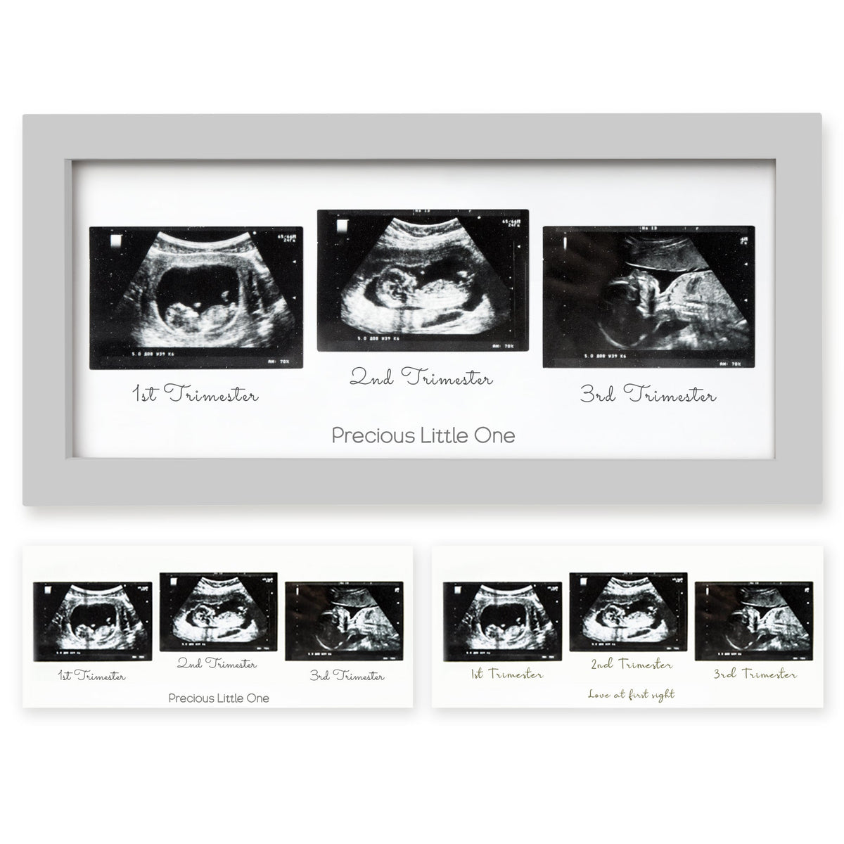 Baby Sonogram Picture Frame
