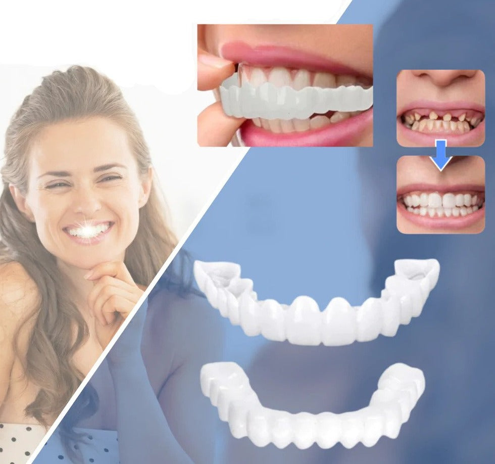 Aufsteckbare kosmetische Veneers | Sofortige Verbesserung des Lächelns | Kein Klebstoff erforderlich | Flexible, wiederverwendbare Zahnabdeckungen zum Essen und Trinken