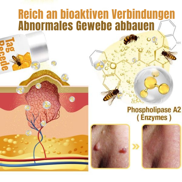 Spray voor het verwijderen van huidoneffenheden en wratten - Bijengifformule - Pijnvrije applicatie - Voor alle huidtypen - Behandeling voor gezicht, nek en lichaam