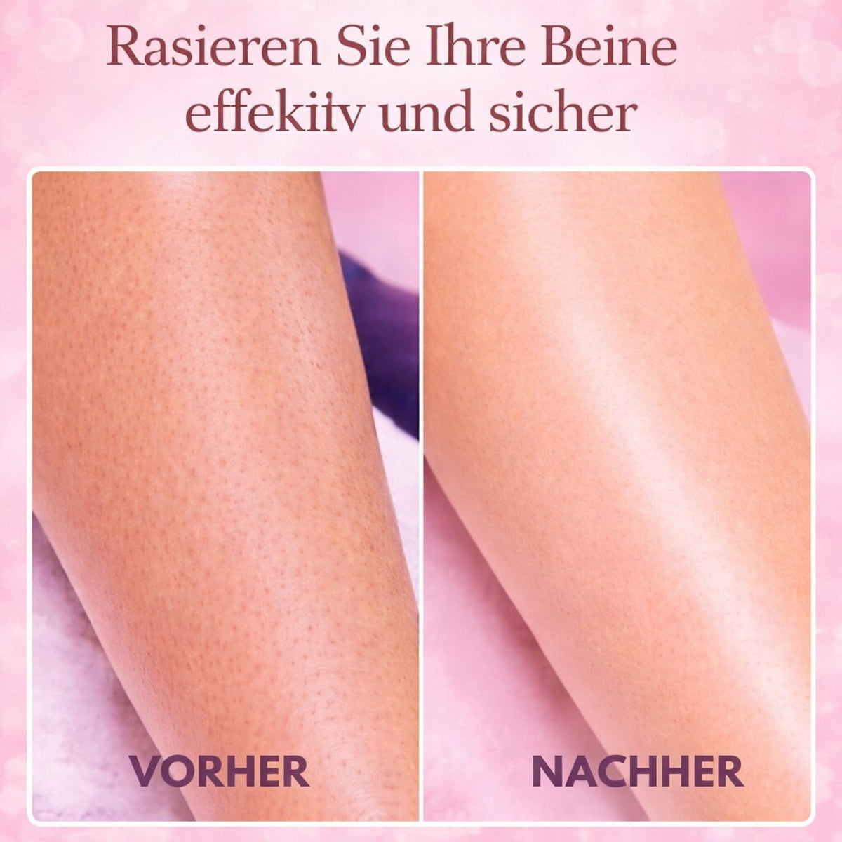 Intimrasierer Electric Shaver For Women